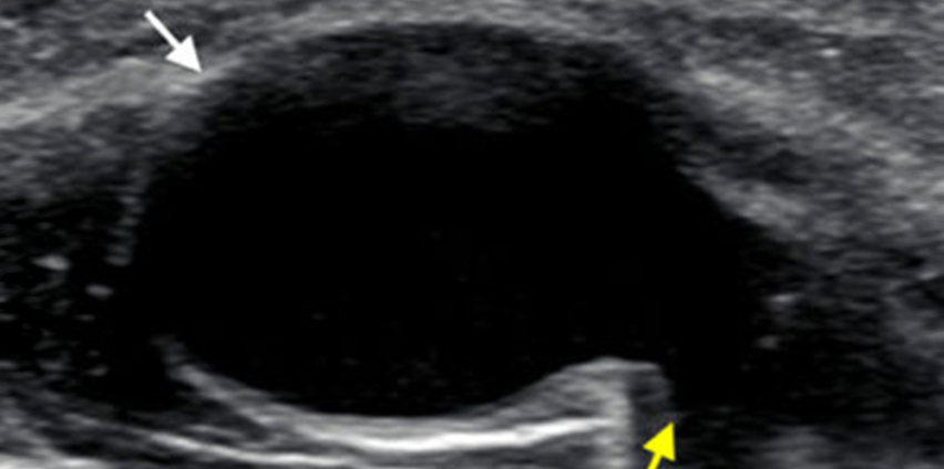  Ultrasound Guided MSK Intervention